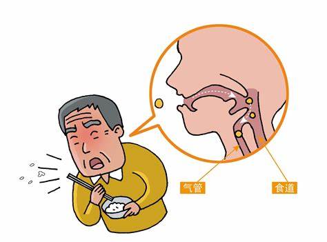 吞咽障碍是什么？哪些疾病可以导致吞咽障碍？