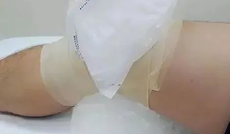 杭州英智康复医院：运用康复训练解决膝关节伤病
