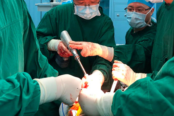 杭州未来科技城医院_膝关节康复_右膝关节单髁表面置换术案例