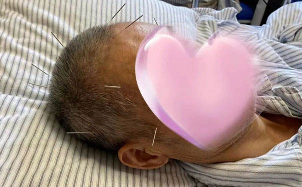 杭州顾连玺桥康复医院脑外科术后康复，70岁老人重获新生